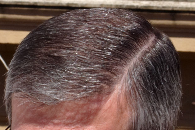 Den sicilianske skilning